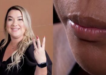 Grávida de cinco meses é agredida por mais de uma hora pela ex-patroa no Maranhão